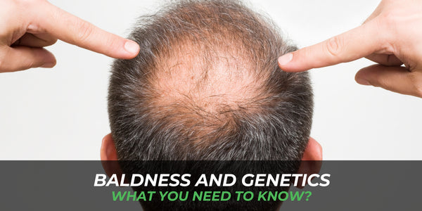 Baldness and Genetics: What you need to know?
