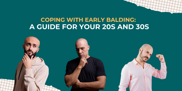Coping with Early Balding: A Guide for Your 20s and 30s